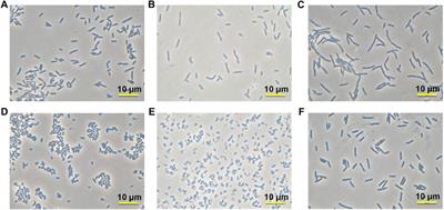 Baseline investigation on soil solidification through biocementation using airborne bacteria